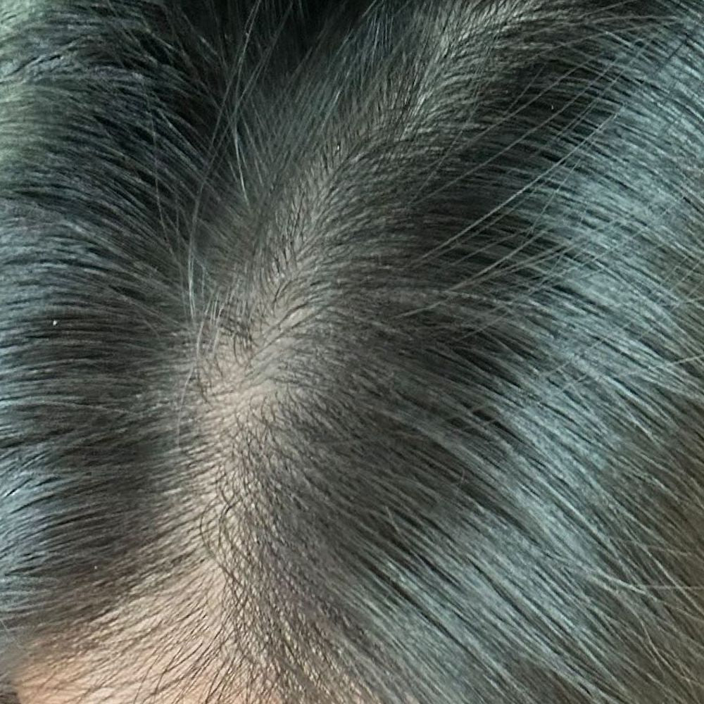 Real results from real skelp customer. Showing review of hair after using skelp! haircare products. No more dandruff showing in after image.